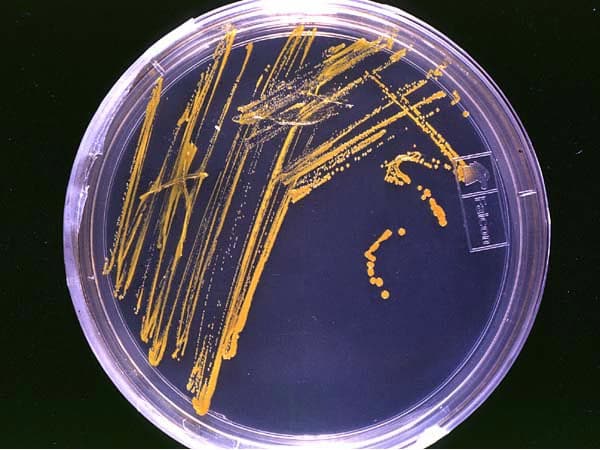 A petri dish of agar with streaked orange bacterial colonies